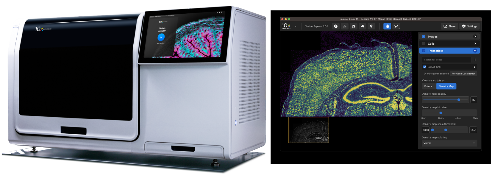 A medical imaging device with a display showing brain scan data.